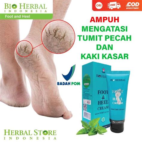 Cara Ampuh Atasi Kaki Pecah Kering Agar Lembut Kembali