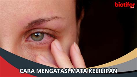 cara mengatasi mata kelilipan di Indonesia