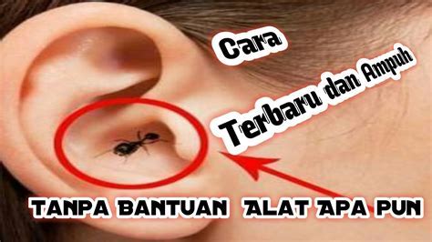cara mengeluarkan lalat dari telinga
