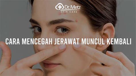 cara menghindari jerawat