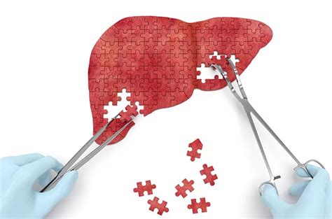 cara menjaga kesehatan liver