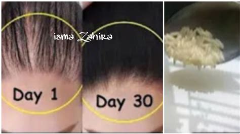 Cara Menumbuhkan Rambut Botak pada Wanita: Rahasia Rambut Tebal nan Menawan