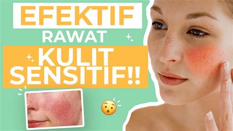 Cara Merawat Wajah Sensitif Jerawat: Tips Ampuh untuk Kulit Sehat