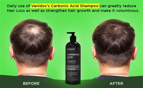 carbonic acid hair shampoo scam