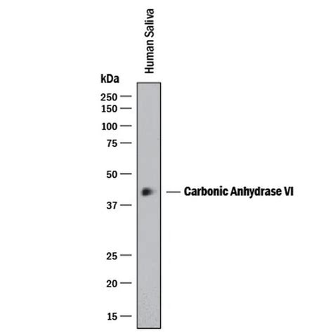 carbonic anhydrase vi igm abs high