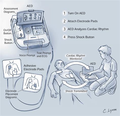 Cardiac Defibrillator Function