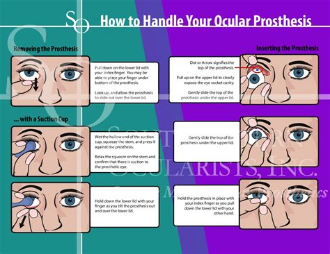Care Of Eye Prosthesis