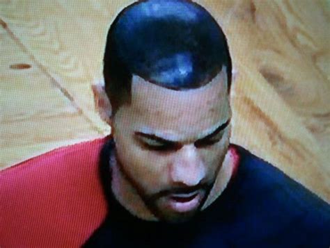 carlos boozer painted hairline