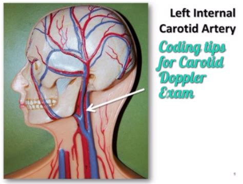 carotid arteriogram cpt code