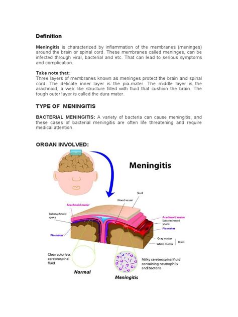 case study bacterial meningitis