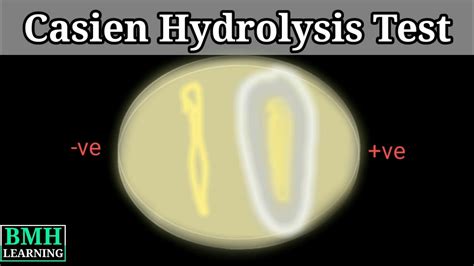 Rose & Lindsey's Medical Microbiology Blog Casein Hydrolysis Test