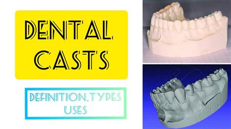 Cast Use Examples