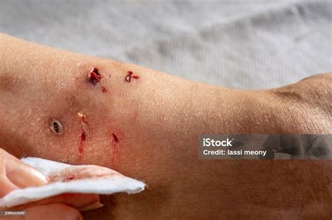 Cat Bite Peroxide