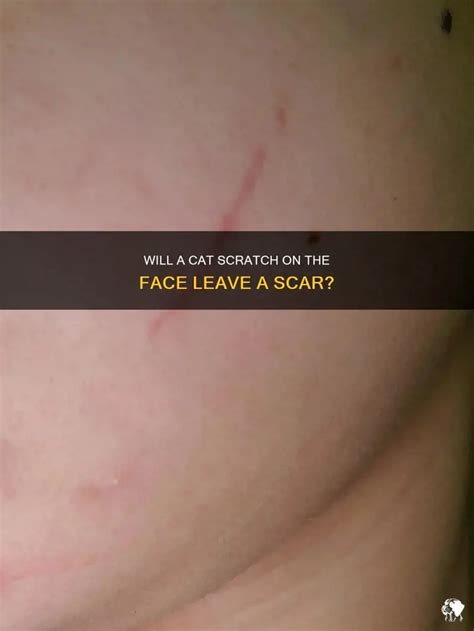 Cat Scar On Face