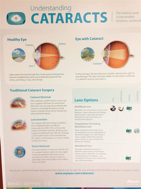 cataract surgeon ratings by patient reviews