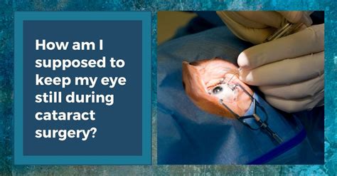 cataract surgery anesthesia options