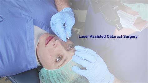 cataract surgery in warrenton va