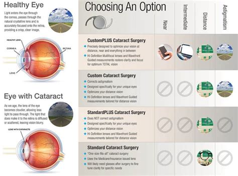 cataract surgery lens options pros and cons