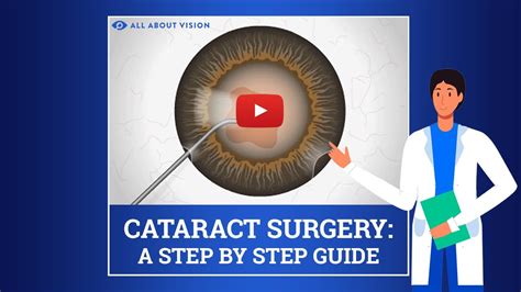 cataract surgery procedure youtube