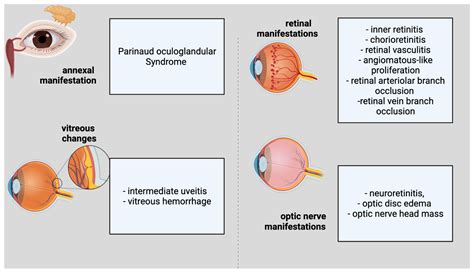 Catch Eye Disease