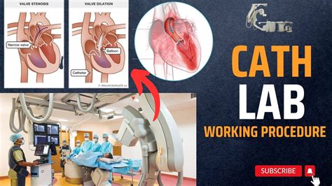 Cath Lab Explained