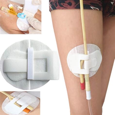 catheter bandages