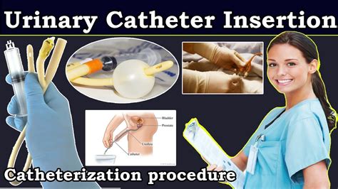 Catheter Instructions Video