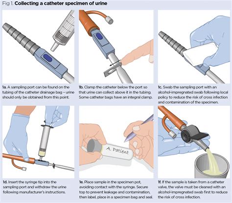 catheter urine sample procedure