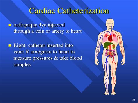 Catheterization Medical Terminology