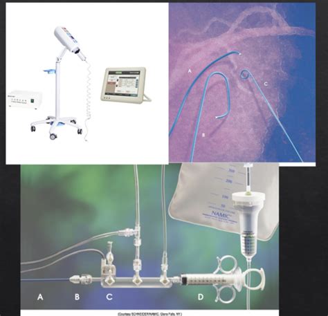 Catheterization Quizlet