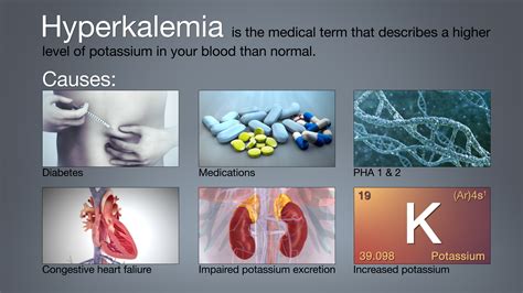 Hyperkalaemia (high potassium level in the blood) Health Life Media