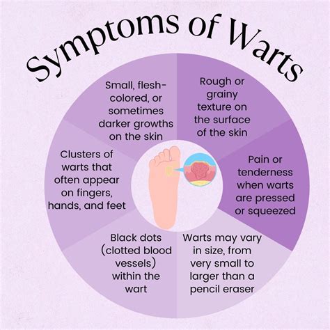 Uncovering the Root Cause of Warts: What You Need to Know
