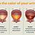 causes of blood in urine elderly female