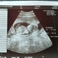 causes for 2 miscarriages in a row