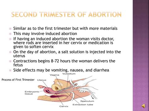 causes of abortion in second trimester