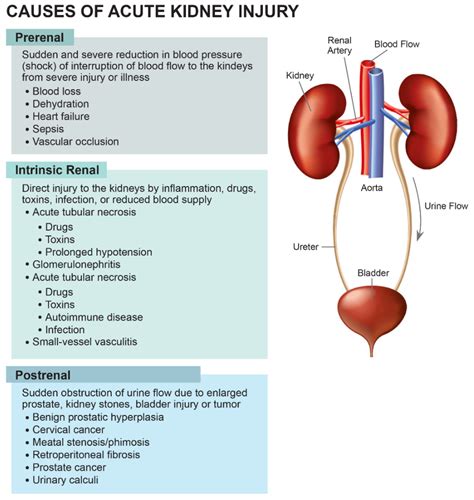 Understanding the Causes of AKI: Uncovering the Hidden Risks to Kidney Health