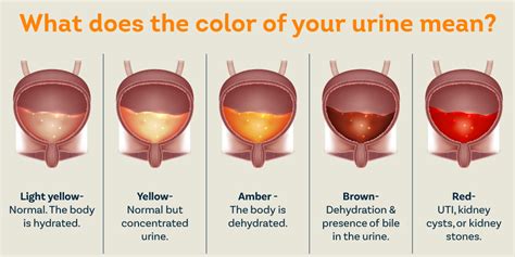 causes of bloody urine with catheter in