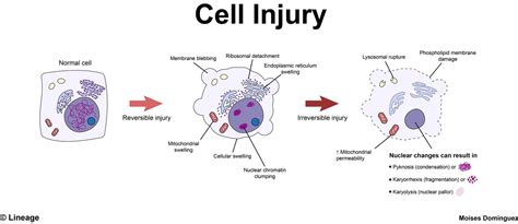 causes of cell injury with examples