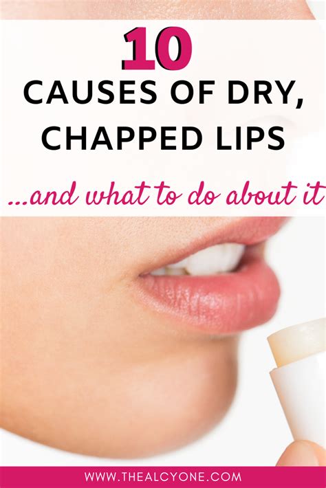 Causes Of Cracked Dry Lips