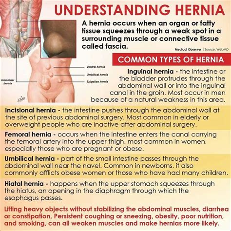 causes of inguinal hernia in men