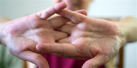 Causes Of Knuckle Cracking