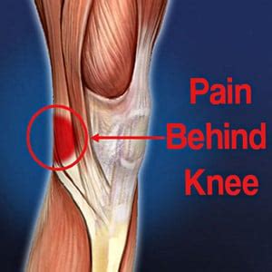 causes of leg tendon pain behind the knee