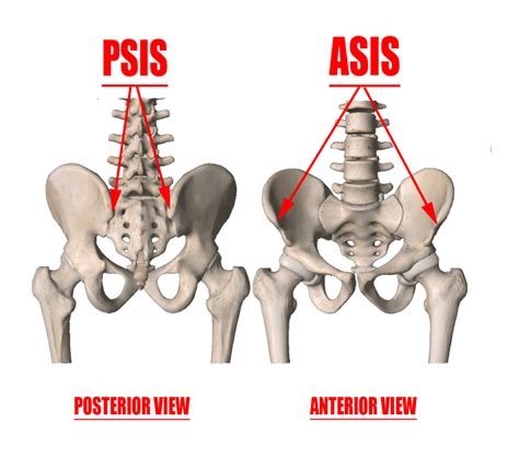causes of psis pain