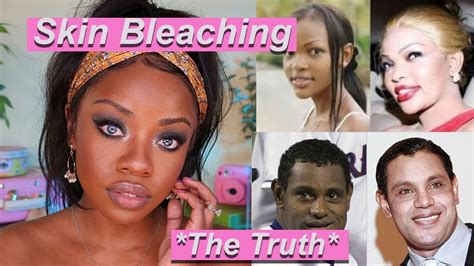 What are the Side Effects of Skin Bleaching? Tonique Skincare