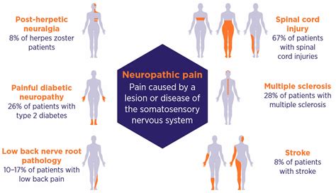 causes of widespread nerve pain