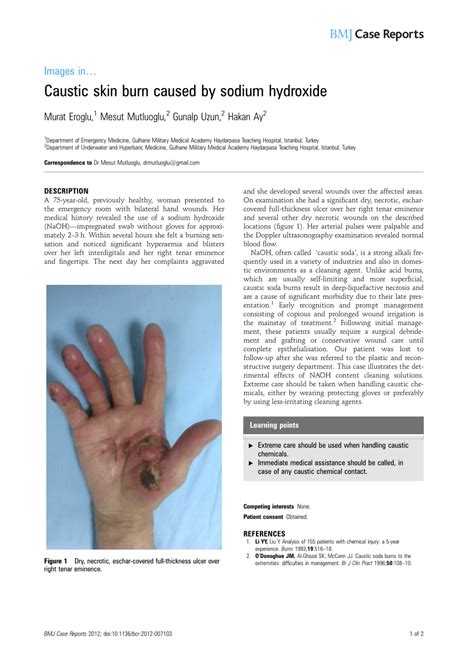 Caustic Skin Exposure