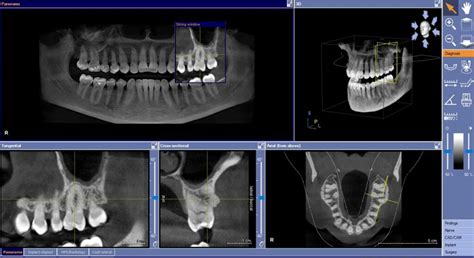 Cbct X Ray Dental Code