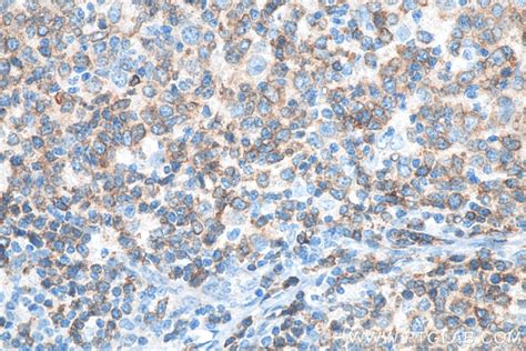 cd antigen cd79a antibody