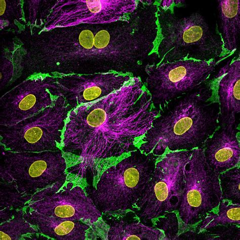 cd31 endothelial cell marker