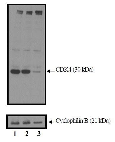 cdk4 antibody western blot